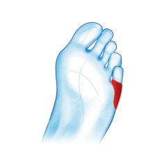 MS469 Protect Gel Προστατευτικό Μικρού Δακτύλου